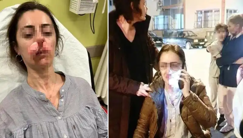 Eşinin Sevgilisi Sandığı Araç Kapısıyla Saldırdı: Olayın detayları şok edici